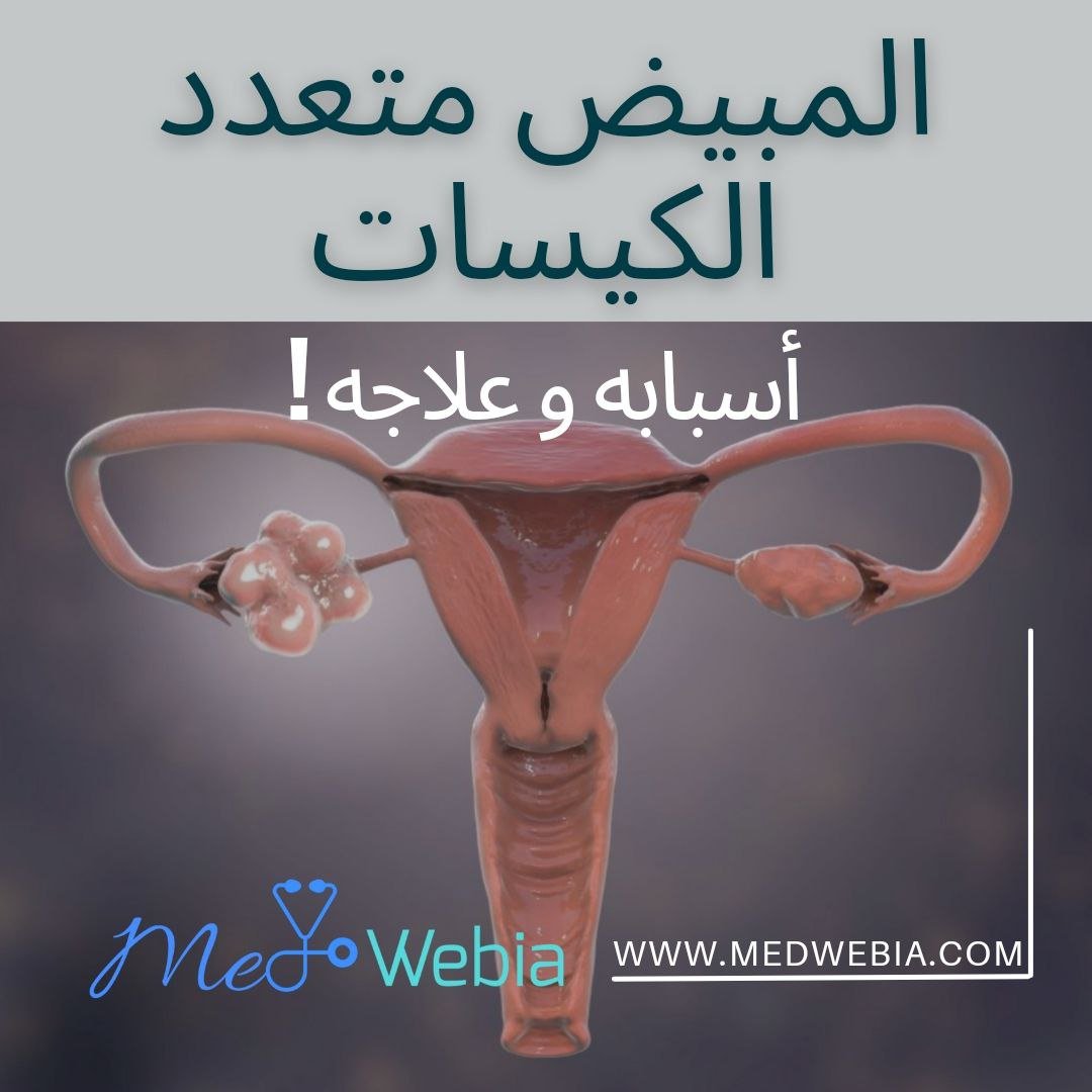 المبيض-متعدد-الكيسات